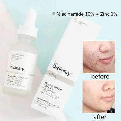 THE ORDINARY NIACINAMIDE 10%+ ZINC 1% FACE SERUM (ORIGINAL)